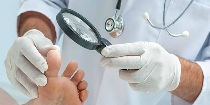 Lekarz bada stopę pacjenta z kolcem z lupą