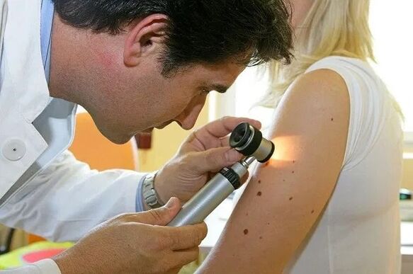 diagnostyka brodawczaków